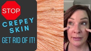 Crepey Skin Go Away [upl. by Denice]