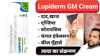 मात्र 5 दिन मे दाद खाज खुजली जड़ खत्म ।। dad khaj khujali ki dava ।। lupiderm gm cream uses Hindi [upl. by Johny]