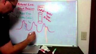 Haemodynamics Part 6 Arterial Line [upl. by Albers4]