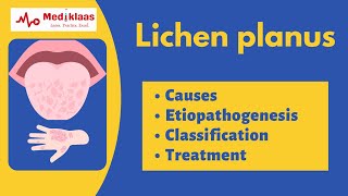 Lichen planus l Causes symptoms treatment l Oral pathology l Mediklaas [upl. by Benioff]