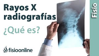 RX o radiografía  ¿Qué es y cómo funciona [upl. by Nona]