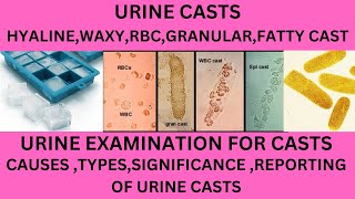 URINARY CASTS IN HINDI DIFFERENT TYPE OF CASTS IN THE URINECAUSES SIGNIFICANCE OF URINE CASTS [upl. by Essila145]