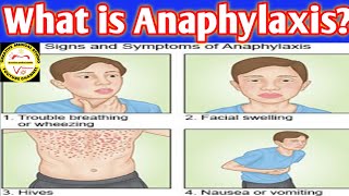 What is Anaphylaxis Signs causes and treatment of anaphylaxis [upl. by Phonsa]