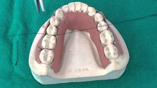 Peridontal Suturing Techniques [upl. by Alvita]