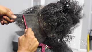 Picking BIG scalp flakes Psoriasis and Dermatitis SEW IN WEAVE REMOVAL [upl. by Aihtak537]