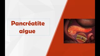 Pancréatite aigue [upl. by Mcnutt]