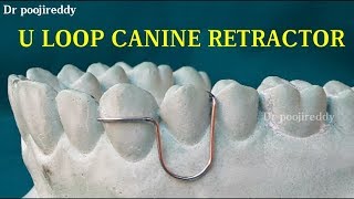 U loop canine retractororthodontic wire bending Dr poojireddy [upl. by Hsevahb986]