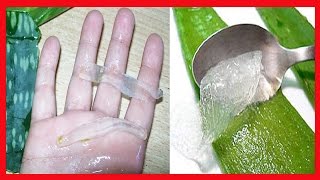 HEMORROIDES ➜ Remedios Naturales Para Las Hemorroides Con Sabila ó Aloe Vera [upl. by Akemrej565]