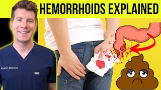 Doctor explains HEMORRHOIDS aka piles  Causes symptoms treatment amp prevention [upl. by Jess237]