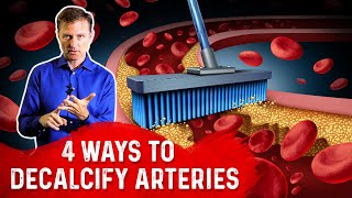 4 Ways To Decalcify Your Arteries – Dr Berg [upl. by Ungley]