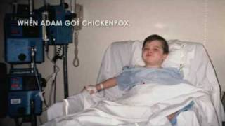 Chickenpox A Familys Story full video [upl. by Hara197]