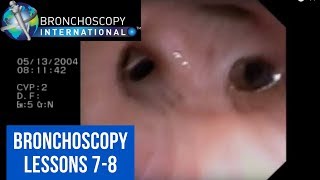 Bronchoscopy Step by Step Details Lessons 78 [upl. by Sebastien]