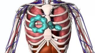 Understanding Food Allergy [upl. by Draw86]