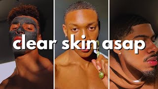 how to get clear skin for guys asap no bs guide [upl. by Marysa307]