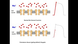 Mechanism of Brugada in a nutshell English Version [upl. by Macilroy887]