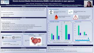 261 RoboticAssisted Bladder Diverticulectomy RABD A safe alternative to open approach [upl. by Eico]