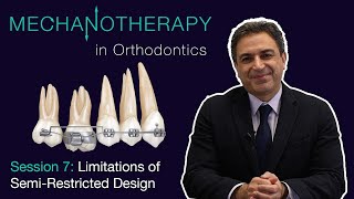 Mechanotherapy in Orthodontics Vol II Limitations of SemiRestricted Design 007 [upl. by Serafine]