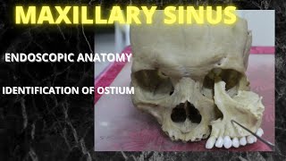 045 Anatomy Maxillary Sinus anatomylectures [upl. by Vanhomrigh]