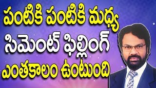 పంటికి మధ్యలో సిమెంట్ ఫిల్లింగ్ ఎంతకాలం ఉంటుంది  Cement Filling In Teeth Telugu  dr raos dental [upl. by Niajneb287]