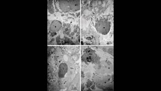 Occurrence of eosinophil extracellular trap cell death in COPD – Video abstract 115969 [upl. by Ilek]