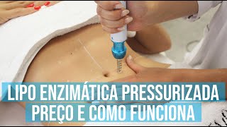 Lipo Enzimática Pressurizada Preço e como funciona [upl. by Tippets]