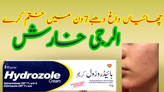 Hydrozolecream Uses and Banefit side effects Best Removal Cream Anti Fungal Topical Skin infection [upl. by Atiuqa]