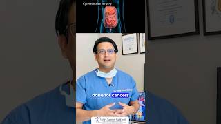 What Happens During HIPEC Surgery new cancer HIPEC [upl. by Jamaal]