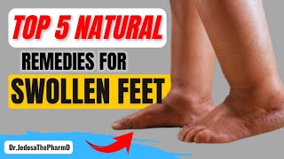 Athletes Foot Fungus Cure in 3 Minutes Simple Home Trick [upl. by Eggleston16]