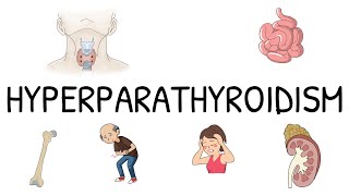 Hyperparathyroidism Primary Secondary and Tertiary  Simple and easy to understand [upl. by Notsud168]