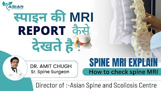 How to check Spine MRI Film l Understand Spine MRI by Dr Amit Chugh l [upl. by Nevar659]