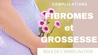 Fibromes utérins et Grossesse  Risques et Complications [upl. by Worrell]