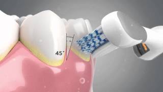 The Technology behind the Colgate® ProClinical® A1500 Electric Toothbrush [upl. by Namlas]