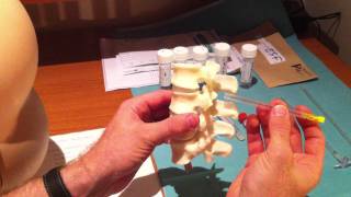 Lumbar Puncture Series  4 Lumbar Spine Anatomy and Needle Trajectory [upl. by Dorrie]