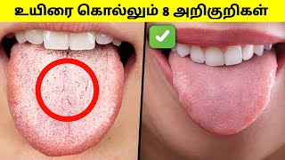 8 dangerous signs⚠️உடனே இதையெல்லாம் Check பண்ணி பாருங்கHealth awarenes mrbrother [upl. by Llirrem]