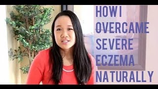 How I Overcame Severe Eczema Naturally [upl. by Rebmak695]