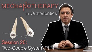 Mechanotherapy in Orthodontics TwoCouple System Pt 4 [upl. by Eltsyrhc466]