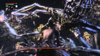 Bloodborne Defiled Chalice Amygdala Strategy Boss Guide [upl. by Shawn]