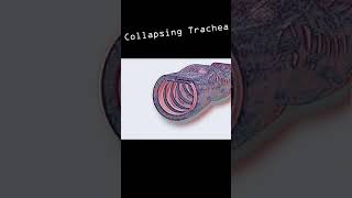 Collapsing Trachea in dogs shorts [upl. by Nosiddam]