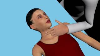 Carotid Sinus Massage technique  VAGAL MANEUVER TECHNIQUE [upl. by Prisilla]