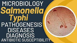 Salmonella typhi microbiology  Typhoid fever pathogenesis by salmonella typhimurium [upl. by Goddard]