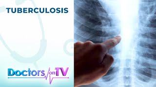 TUBERCULOSIS Symptoms and Treatment  DOTV [upl. by Arand341]