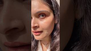 Pimples gone just overnight  pimplefree acneproneskincare ytshortsvideo shortsviral pimplelife [upl. by Roderich]