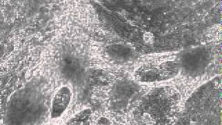 iPS細胞から作られた心筋細胞が拍動するBeating heart cells under microscope [upl. by Ykcir675]