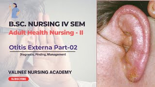 Otitis Externa Part2  Diagnosis Finding Management  Valinee Nursing Academy [upl. by Renrew83]