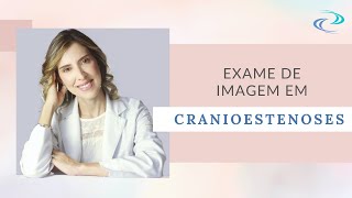 Dra Clarice  Responde Exames de imagem em cranioestenoses [upl. by Koslo]