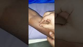 Skin Test Karna Kyu Jaruri hai  Skin me Injection Kaise lagaye Sensitive Skin Test Techniquevideo [upl. by Soll]