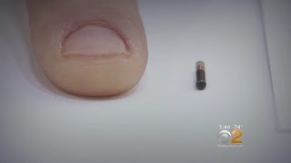 Are Microchip Implants Worth The Risk [upl. by Kelwunn377]