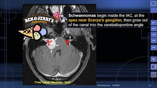 MedPix Video  Phakomatoses  Neurofibromatosis Type 2 Wishart Disease [upl. by Azil]