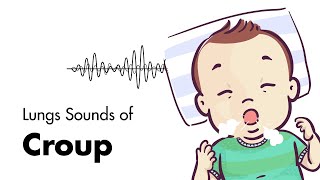 Sounds of Croup Laryngotracheitis  Lung Sounds  MEDZCOOL [upl. by Blossom]