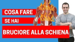 Perchè si può avere BRUCIORE alla schiena e come liberarsene 3 mosse1 [upl. by Kleeman330]